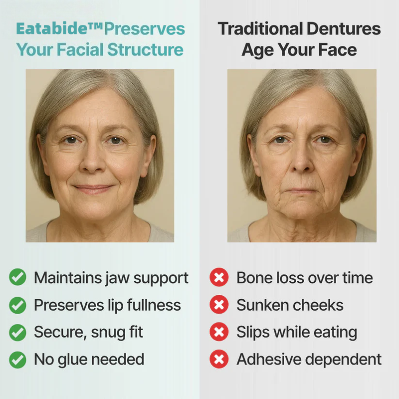 Ends Today: 80% OFF! Eatabide™ Custom-Fit Full Functional DenturesMake you more confident